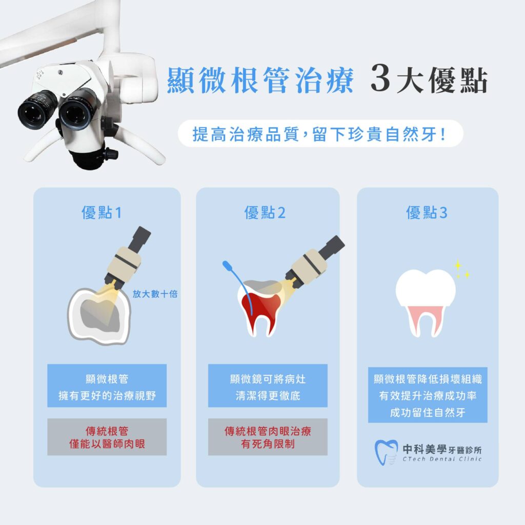 顯微根管治療是什麼？與傳統根管有哪些不同- 中科美學牙醫
